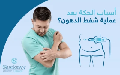 ما اسباب الحكه بعد عملية شفط الدهون؟