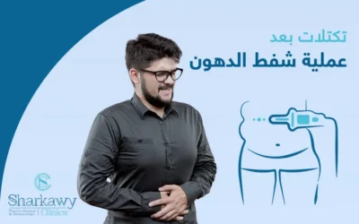 هل ظهور تكتلات بعد عملية شفط الدهون أمر مقلق؟