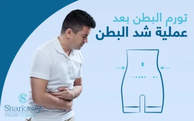 تورم البطن بعد عملية شد البطن