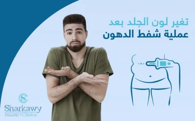 اسباب تغير لون الجلد بعد عملية شفط الدهون وكيف تتجنبها
