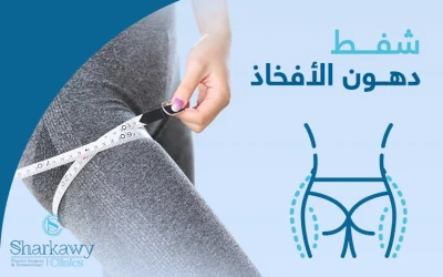 شفط دهون الأفخاذ | الحل الأمثل للتخلص من الدهون العنيدة