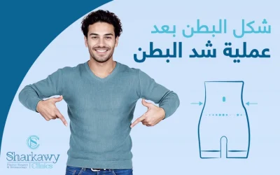 شكل البطن بعد عملية شد البطن | متى يظهر واضحًا؟