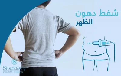 شفط دهون الظهر : الحل الأكيد للتخلص من الدهون الموضعية