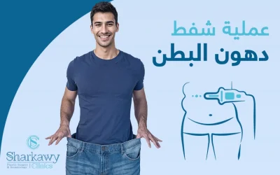 كل ما تريد معرفته عن عملية شفط دهون البطن