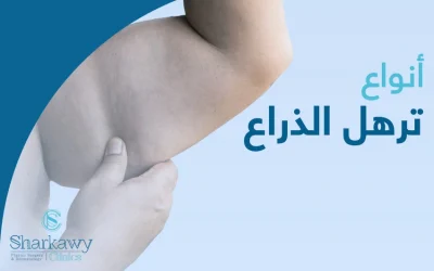 ما هي أنواع ترهل الذراع؟ وما علاجها؟