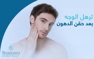 ترهل الوجه بعد حقن الدهون: الأسباب والحلول