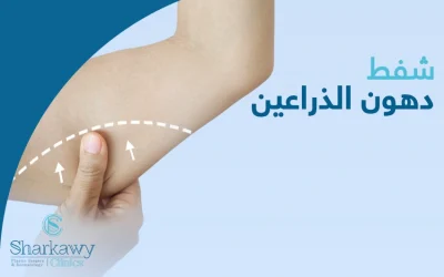 شفط دهون الذراعين بالفيزر: الحل المثالي للحصول على ذراعين مشدودين