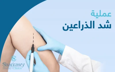 ما يجب أن تعرفه عن عملية شد الذراعين