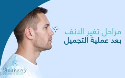 مراحل تغير الانف بعد عملية التجميل