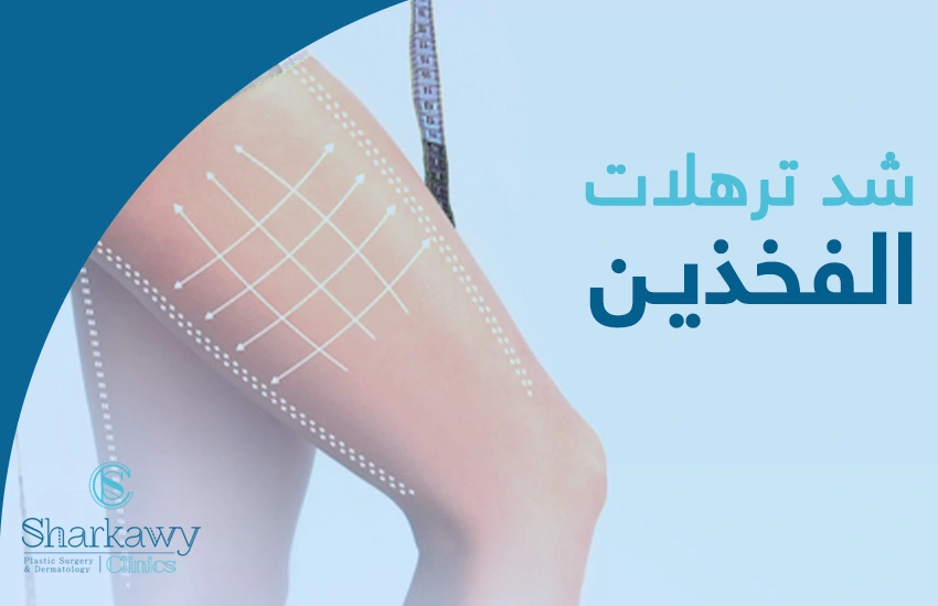 عمليات شد ترهلات الفخذين | دليل شامل دكتور عمر الشرقاوي