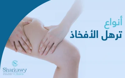 أنواع ترهل الأفخاذ وكيفية التخلص منها بأحدث التقنيات