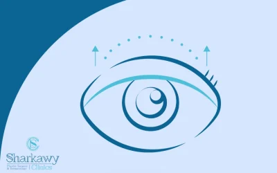 تجميل الجفون | يعيد لعينيك جاذبيتها المعتادة