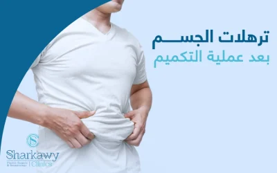 كيفية التخلص من ترهلات الجسم بعد عملية التكميم