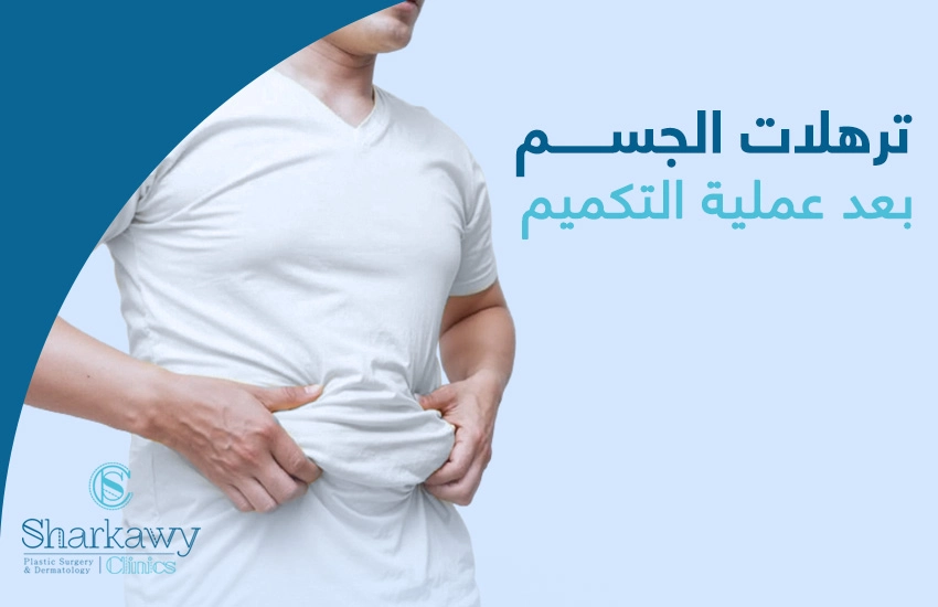 ترهلات-الجسم-بعد-عملية-التكميم ترهلات الجسم بعد عملية التكميم