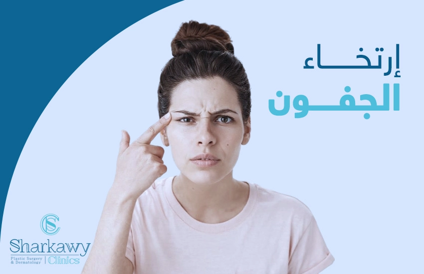 ارتخاء الجفون