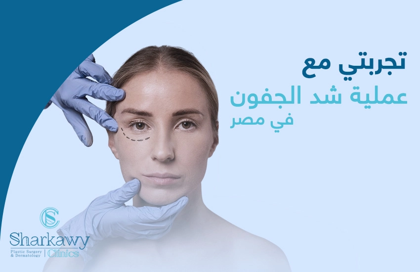 تجربتى مع عملية شد الجفون