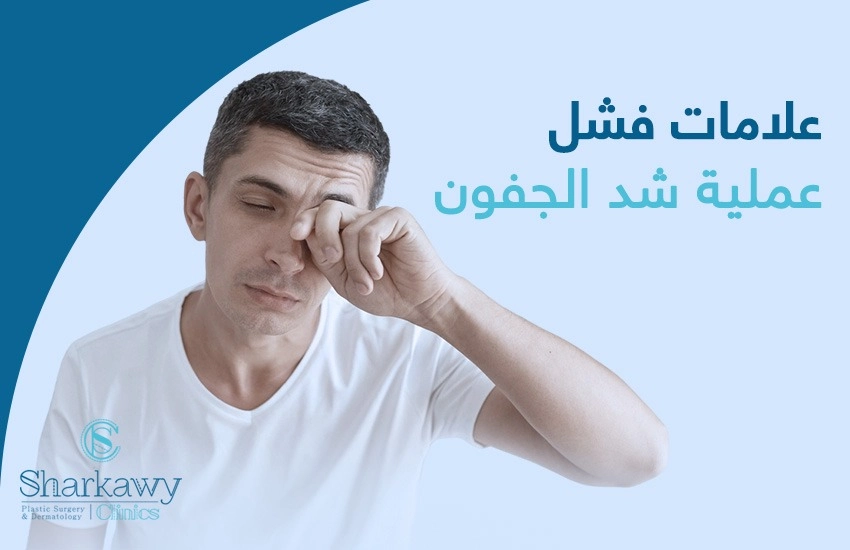 فشل عملية شد الجفون
