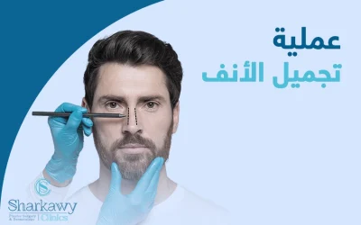 عملية تجميل الأنف