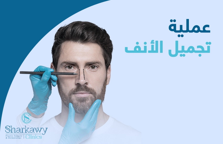 عملية تجميل الأنف