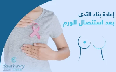 كيف تجرى عملية إعادة بناء الثدي بعد استئصال الورم؟
