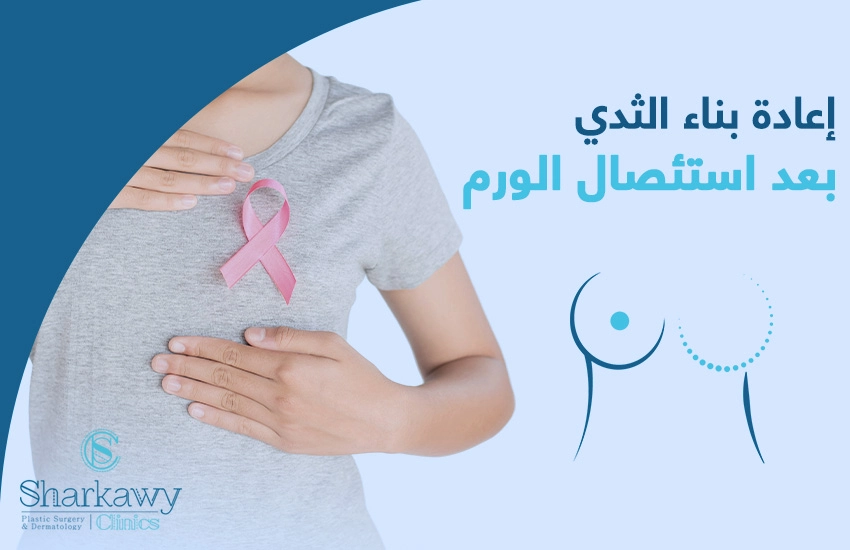 كيف تجرى عملية إعادة بناء الثدي بعد استئصال الورم؟