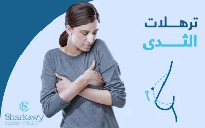 ترهلات الثدي| ما أسبابها؟ وكيف تتخلصين منها؟