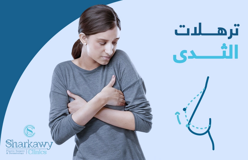 ترهلات الثدي| ما أسبابها؟ وكيف تتخلصين منها؟