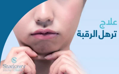 علاج ترهل الرقبة 