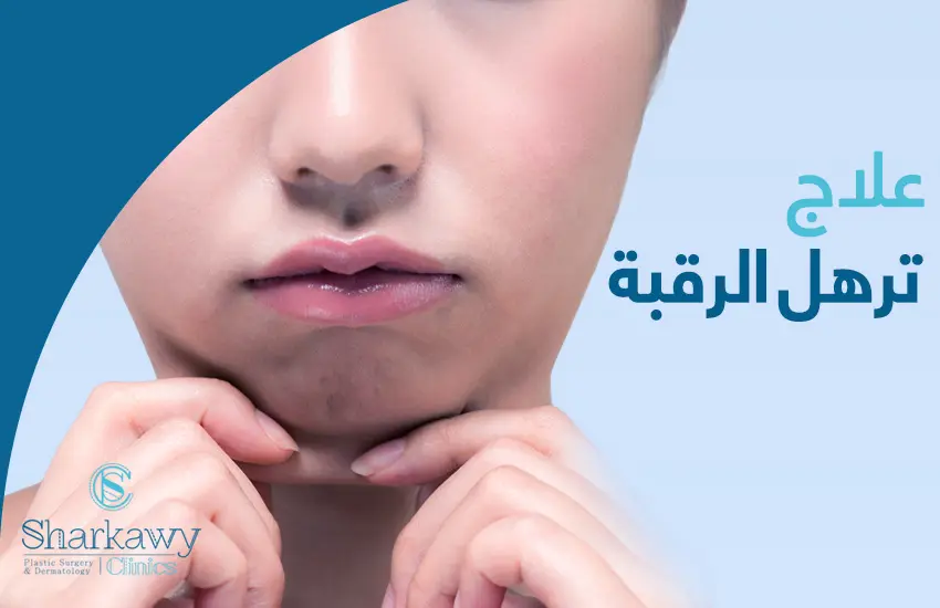 علاج ترهل الرقبة