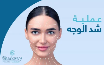 عملية شد الوجه