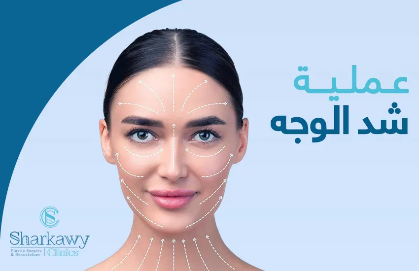 عملية شد الوجه