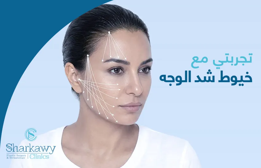 تجربتي مع خيوط شد الوجه.. كل ما تود معرفته عن الإجراء